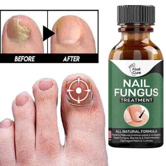 Nail Fungal Repair Serum | Nail Fungus Removal Gel - Raffa Store